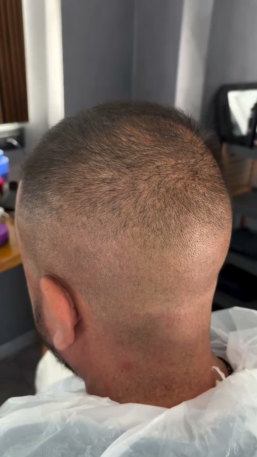Capelli corti osservati prima del cambio colore